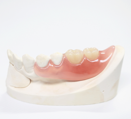 ノンクラスプデンチャー（自由診療の入れ歯）