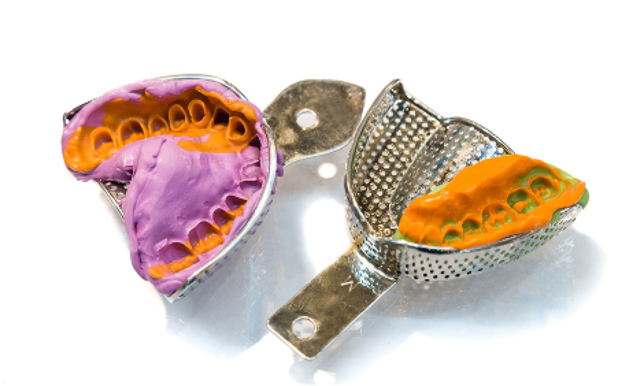 「正しくかみ合わせる」個人トレーでの型取り