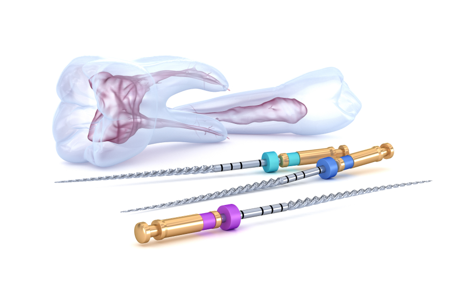 「取りきる」ニッケルチタンロータリーファイル