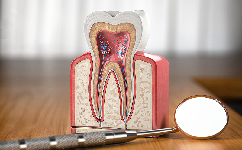 マイクロエンド（根管治療）