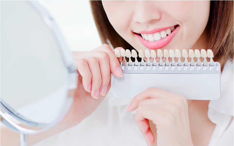 ホワイトニング